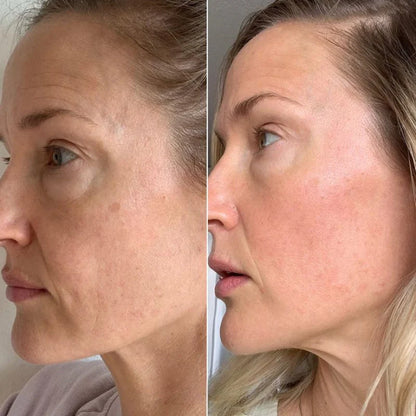 Hydro Beauty Boost