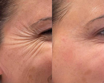Hydro Beauty Boost