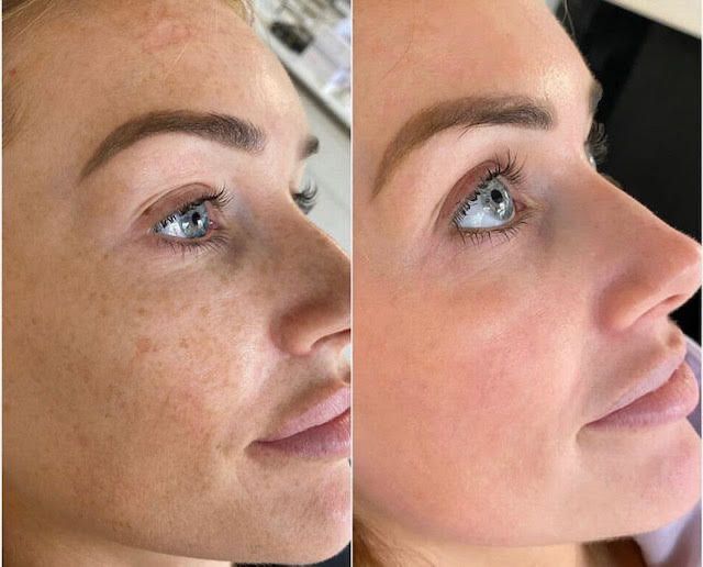 Hydro Beauty Boost