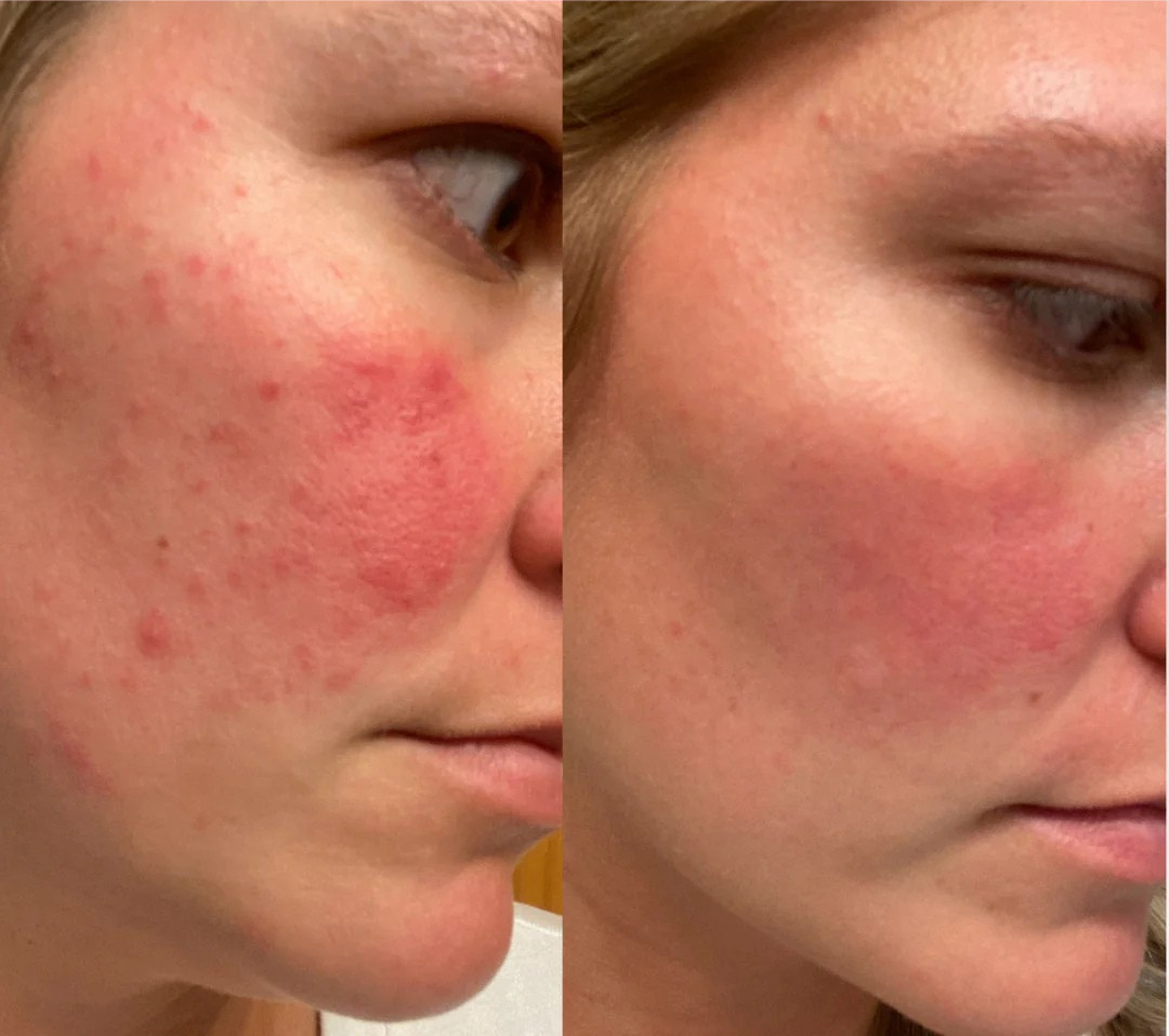 Hydro Beauty Boost