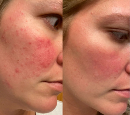 Hydro Beauty Boost